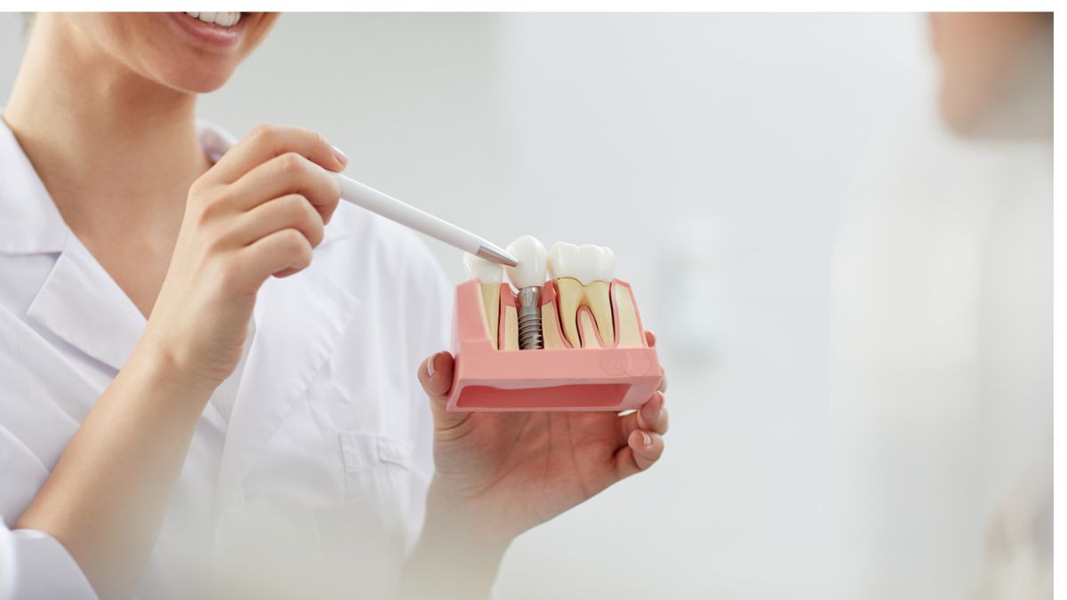 The Ultimate Solution for Missing Teeth