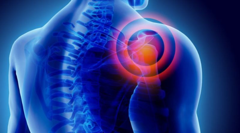 What to Know About Shoulder and Rotator Cuff Injuries at Work